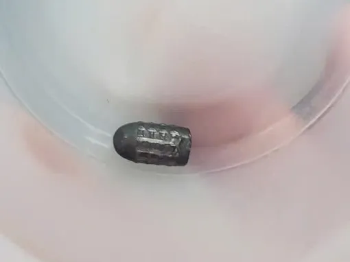 Làm rõ vụ người phụ nữ bị trúng đạn vào đầu khi đang làm vườn Làm rõ vụ người phụ nữ bị trúng đạn vào đầu khi đang làm vườn